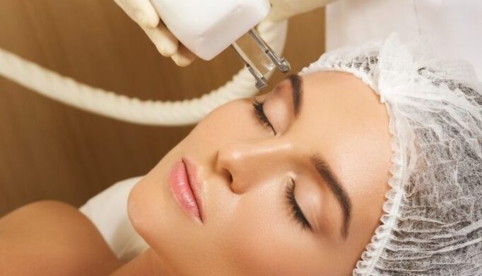 थर्मोलिफ्टिंग