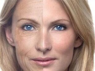 त्वचा का रंजकता