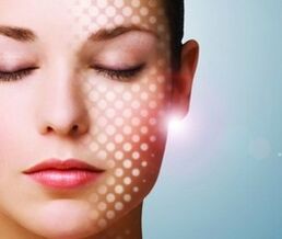 आंशिक चेहरे की त्वचा कायाकल्प का परिणाम है
