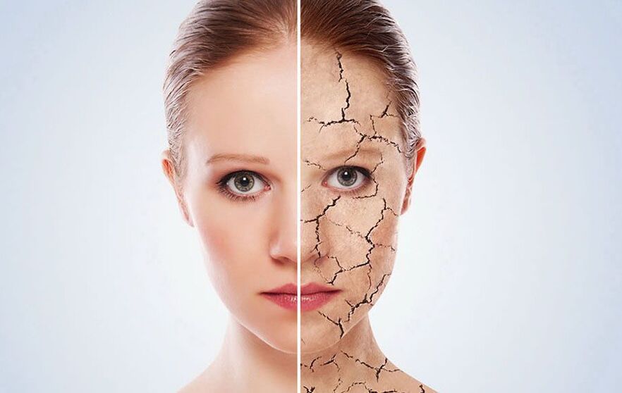 चेहरे की त्वचा को जवान कैसे रखें 
